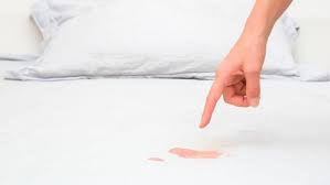 Quitar manchas de sangre en sábanas rápido